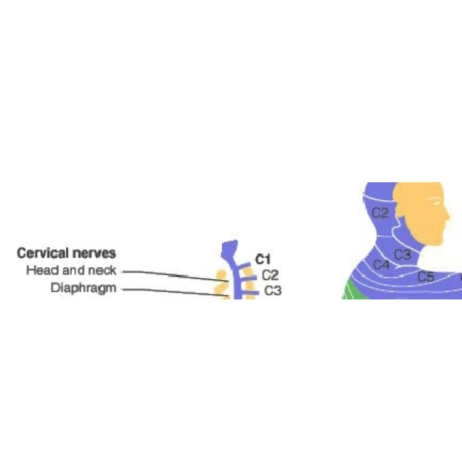 SCI - Spinal Cord Injury - C3 Quadriplegia
